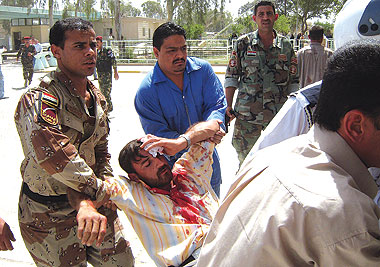 اصابة اثنين من المدنيين في انفجار عبوة لاصقة شرق بغداد