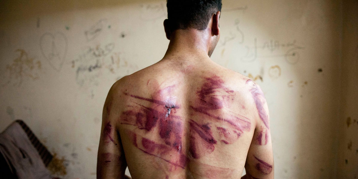 نائب يطالب العبادي بالتدخل لوقف حالات التعذيب في السجون العراقية